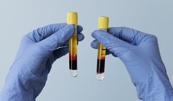 First Time Donating Plasma? Here's What to Expect